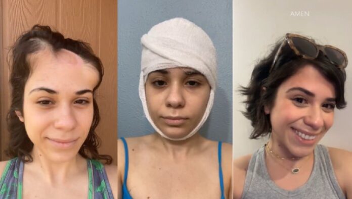 Alondra Sierra chose to document her battle with skin cancer on TikTok