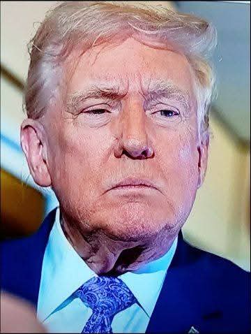 “Even If You Fire Me, America Must Know” — Fired White House Doctor Breaks Silence After Trump–Zelensky Meeting as New Photos Ignite Alarming Health Questions