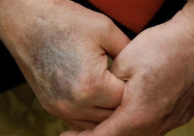 Breaking: Top Trump Advisor Leaks Shocking Details of President’s Secret Health Collapse — Internal Sources Say Condition “Worse Than Reported” as White House Rushes Damage Control