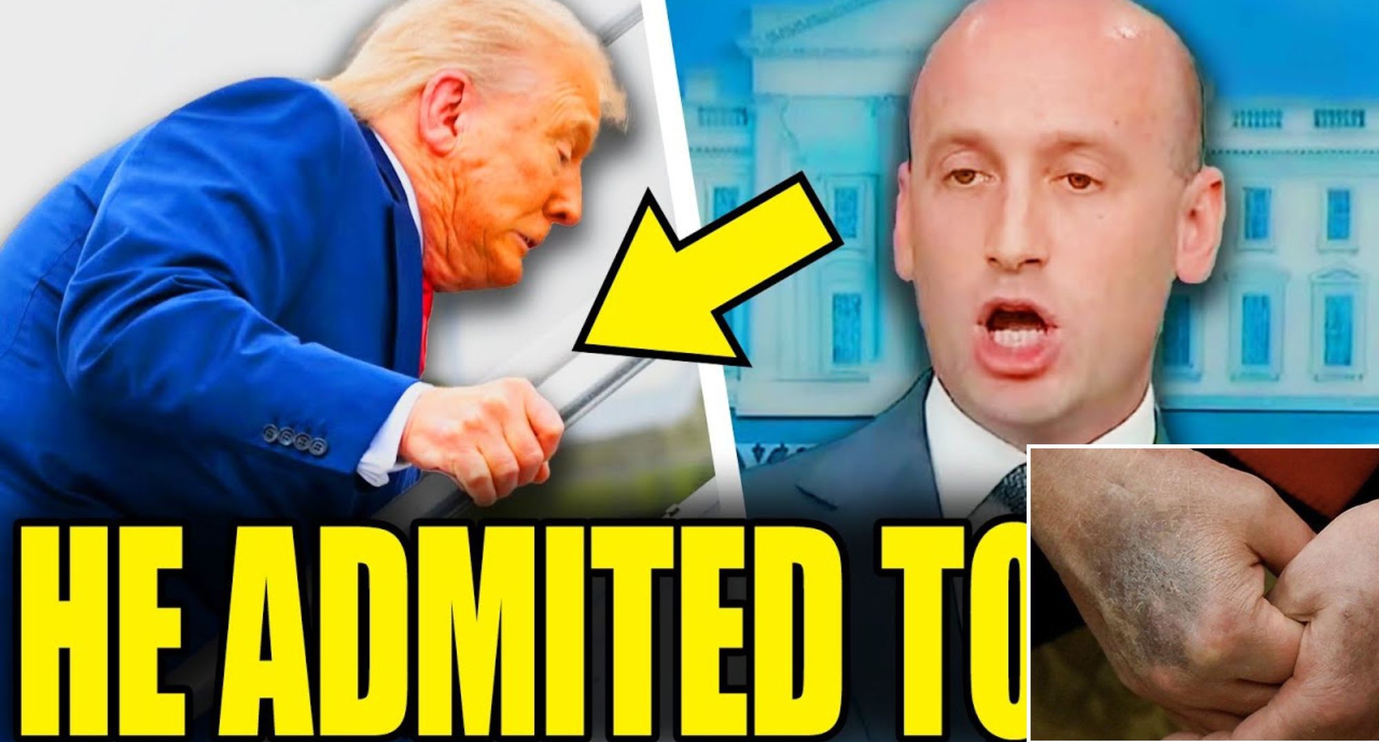 Breaking: Top Trump Advisor Leaks Shocking Details of President’s Secret Health Collapse — Internal Sources Say Condition “Worse Than Reported” as White House Rushes Damage Control