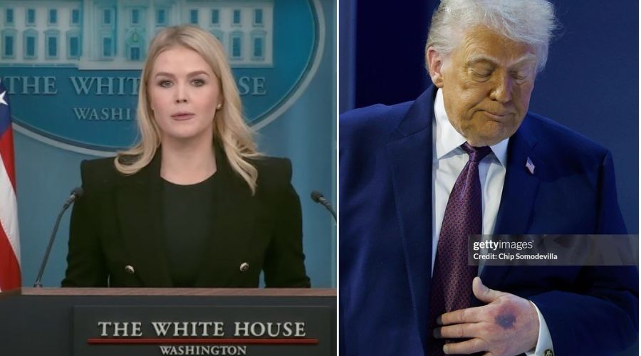 Karoline Leavitt Breaks Down as New Photos EXPOSE Trump’s Health, Showing a Worsening Bruise and Parts of His Body Appearing in Different Colors, Contradicting the Official Explanation