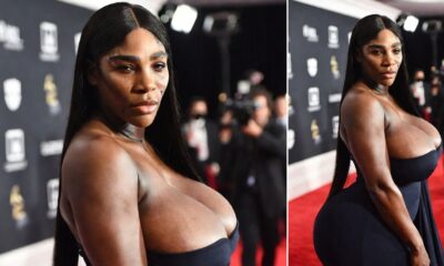 Serena Williams at the Grammys With a Scar on Her Face: Is It Fashion or Something More Disturbing? See Full Details and Photos