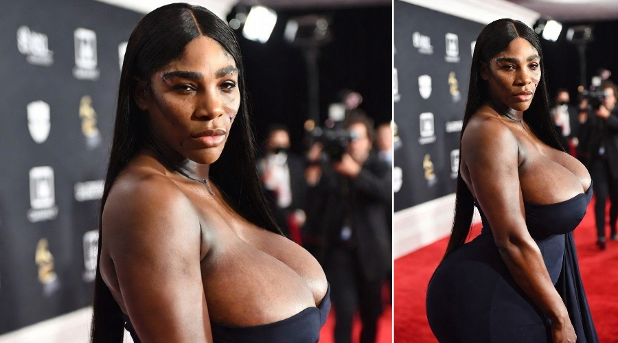 Serena Williams at the Grammys With a Scar on Her Face: Is It Fashion or Something More Disturbing? See Full Details and Photos