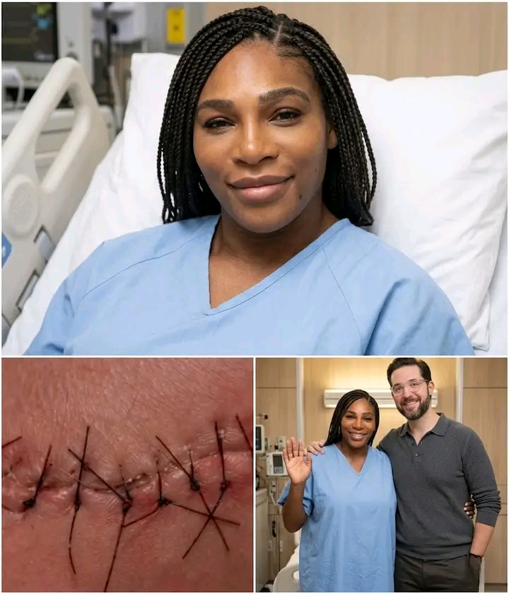 Serena Williams Shares Emotional Health Update After Surgery: “I Am Fighting, But I Cannot Do It Alone”